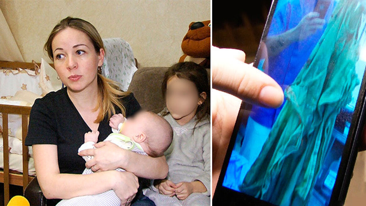 Απίστευτο: Ρώσοι γιατροί έκαναν καισαρική αλλά ξέχασαν... σεντόνι στην κοιλιά της μητέρας!